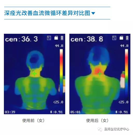 頸椎亞健康有多要命？很危險(xiǎn)！(圖7)