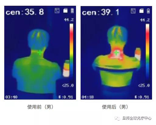頸椎亞健康有多要命？很危險(xiǎn)！(圖8)