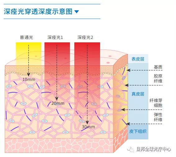 震驚中外的“深痊光”，黑科技臍光寶光療儀發(fā)布！(圖5)